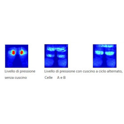 Cuscino antidecubito con compressore a ciclo alternato